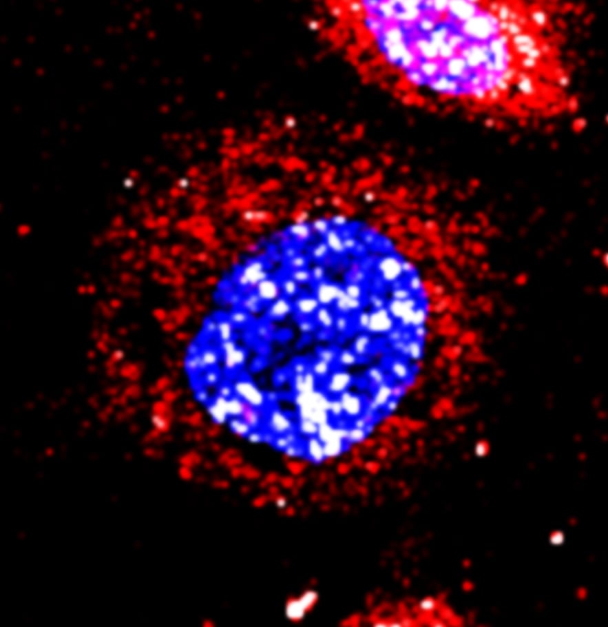 Human TACE/ADAM17 Ectodomain Antibody AF930